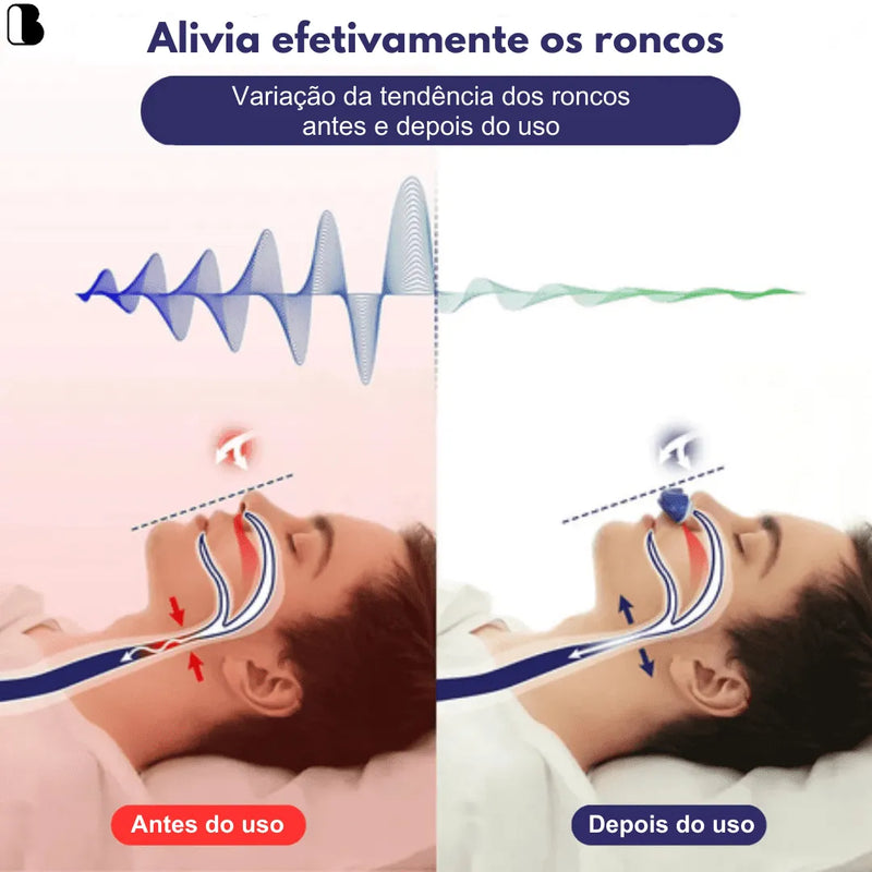 Anti Ronco Eletrônico Micro