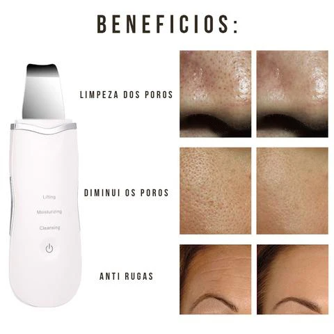 Limpeza de pele Aparelho de Peeling Ultra Sônico Portátil