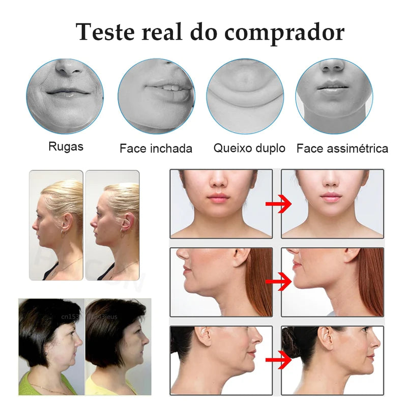 Aparelho Massageador Redutor de Papada e Rugas